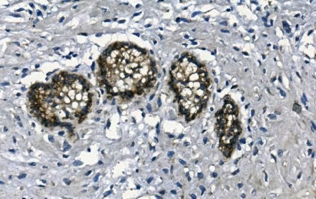 GAA Antibody in Immunohistochemistry (Paraffin) (IHC (P))