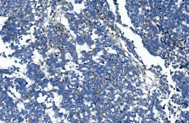 GAA Antibody in Immunohistochemistry (Paraffin) (IHC (P))