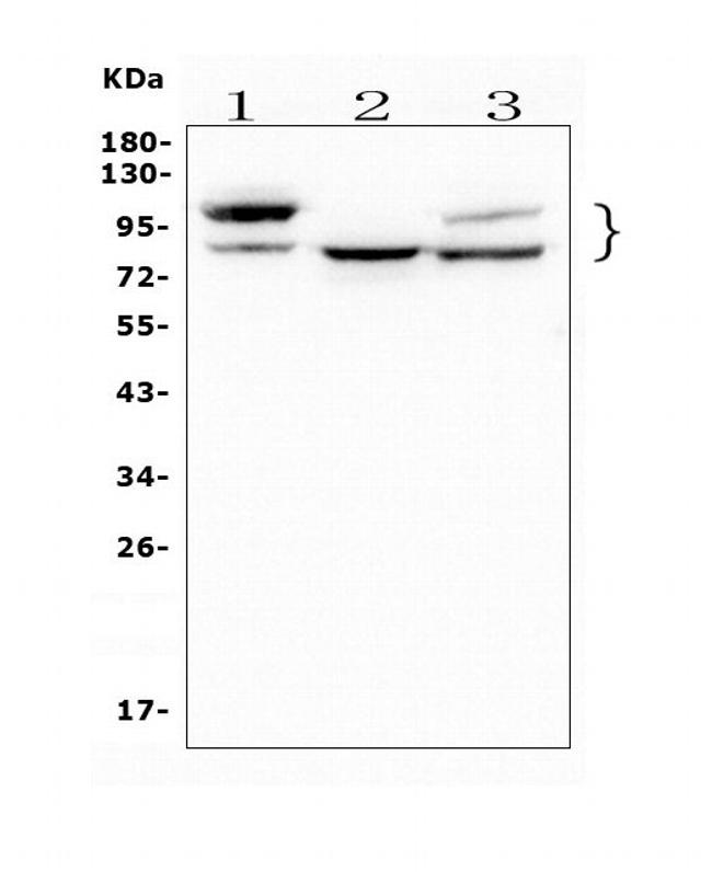 GAA Antibody in Western Blot (WB)