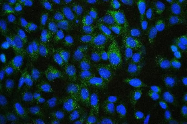 PDCD6IP Antibody in Immunocytochemistry (ICC/IF)