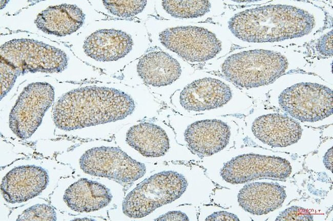 PDCD6IP Antibody in Immunohistochemistry (Paraffin) (IHC (P))