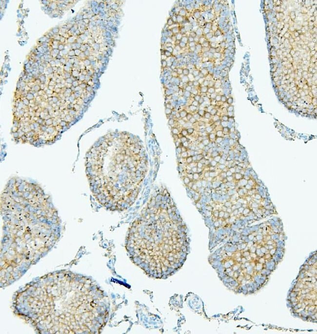 PDCD6IP Antibody in Immunohistochemistry (Paraffin) (IHC (P))