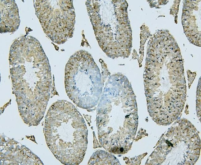 PDCD6IP Antibody in Immunohistochemistry (Paraffin) (IHC (P))