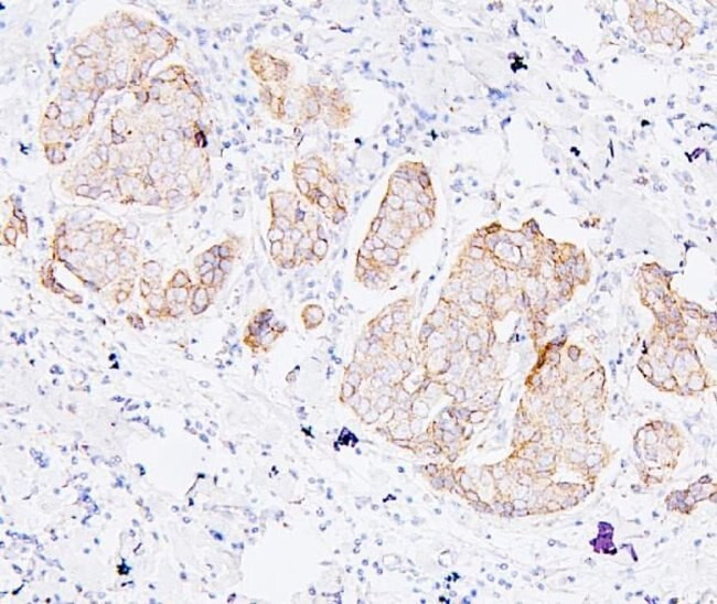 PDCD6IP Antibody in Immunohistochemistry (Paraffin) (IHC (P))