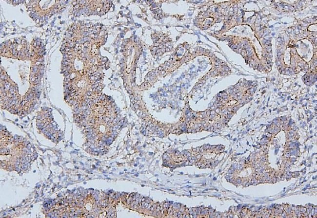 PDCD6IP Antibody in Immunohistochemistry (Paraffin) (IHC (P))