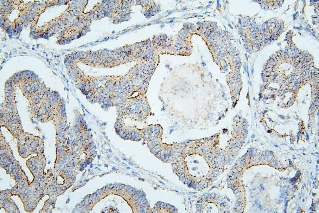 PDCD6IP Antibody in Immunohistochemistry (Paraffin) (IHC (P))