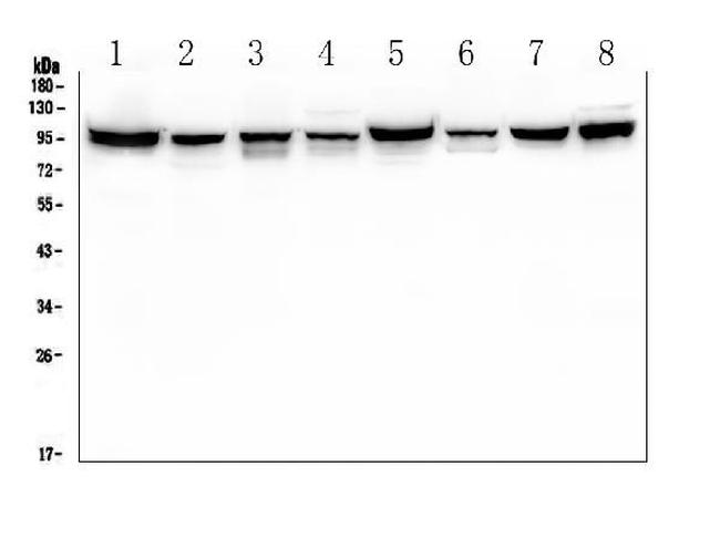 PDCD6IP Antibody in Western Blot (WB)