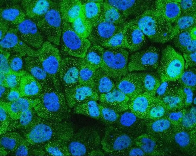 HSPH1 Antibody in Immunocytochemistry (ICC/IF)