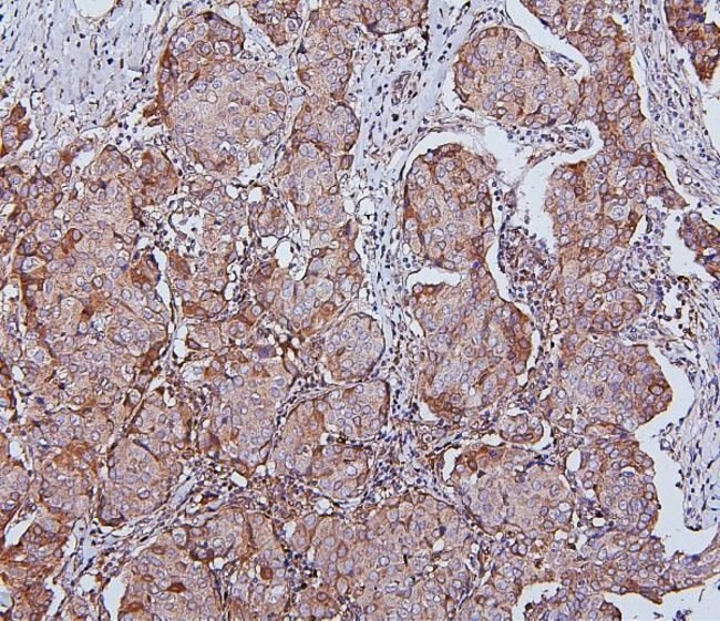 HSPH1 Antibody in Immunohistochemistry (Paraffin) (IHC (P))