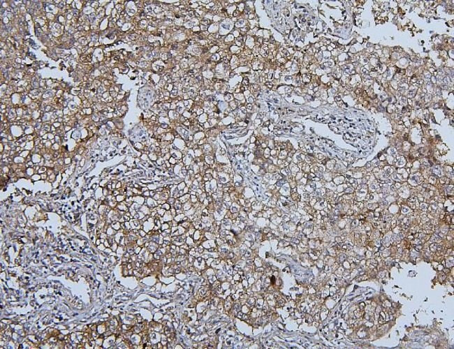 HSPH1 Antibody in Immunohistochemistry (Paraffin) (IHC (P))