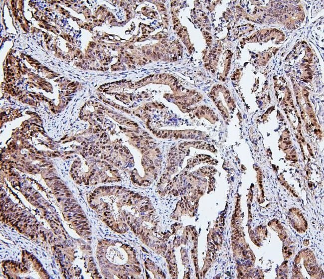 HSPH1 Antibody in Immunohistochemistry (Paraffin) (IHC (P))