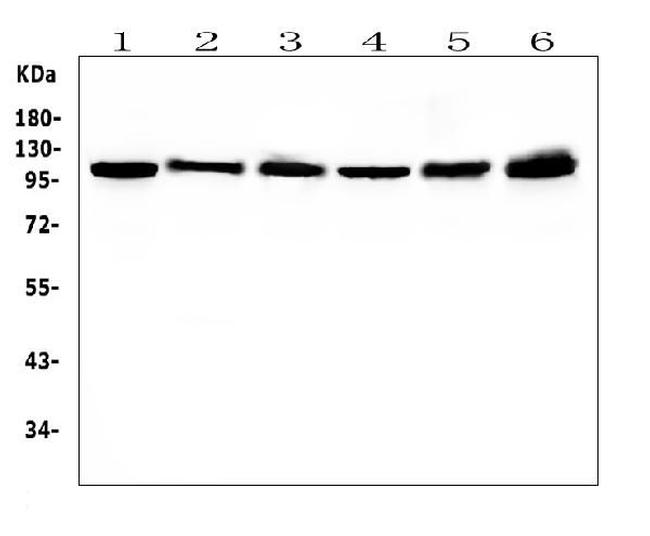 HSPH1 Antibody in Western Blot (WB)