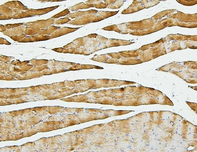 CFL2 Antibody in Immunohistochemistry (Paraffin) (IHC (P))