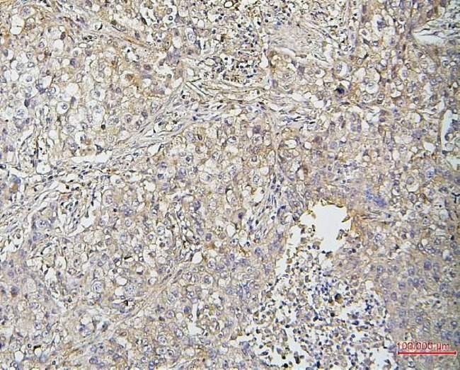 CFL2 Antibody in Immunohistochemistry (Paraffin) (IHC (P))