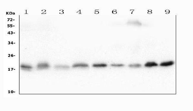 CFL2 Antibody in Western Blot (WB)