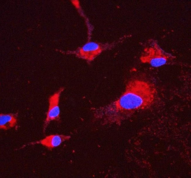 ATP5H Antibody in Immunocytochemistry (ICC/IF)