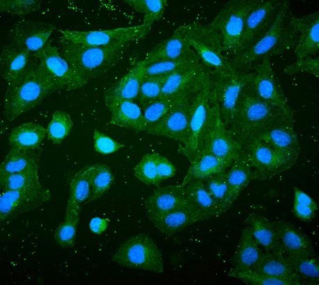 RP2 Antibody in Immunocytochemistry (ICC/IF)