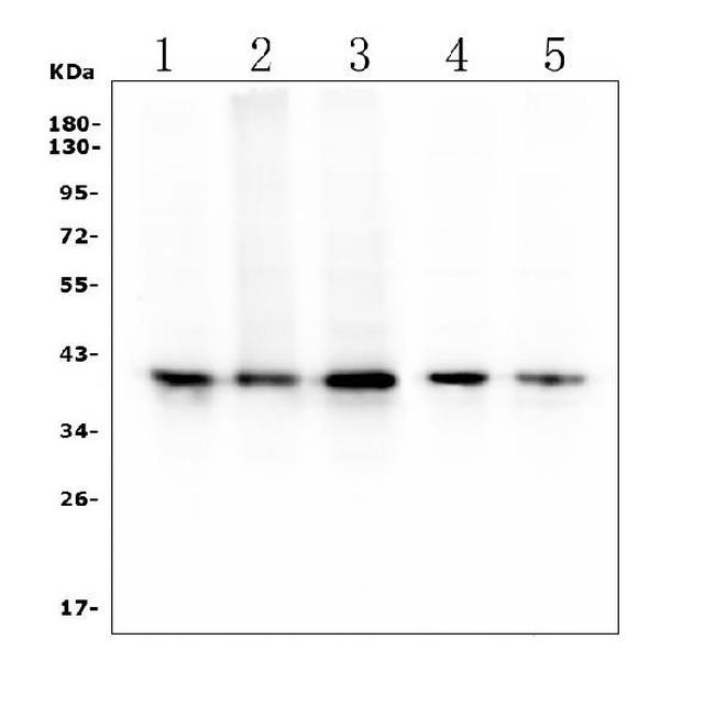 RP2 Antibody in Western Blot (WB)