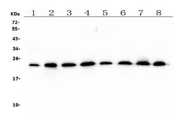 RAB11B Antibody in Western Blot (WB)