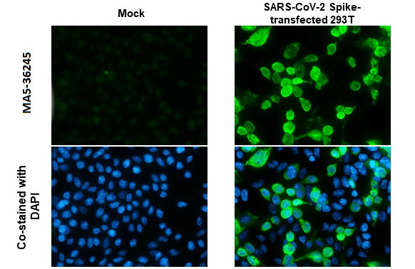 SARS-CoV-2 Spike Protein S1 Antibody in Immunocytochemistry (ICC/IF)