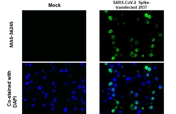 SARS-CoV-2 Spike Protein S1 Antibody in Immunocytochemistry (ICC/IF)