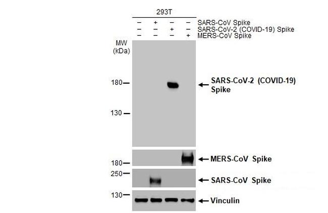 SARS-CoV-2 Spike Protein S1 Antibody in Western Blot (WB)