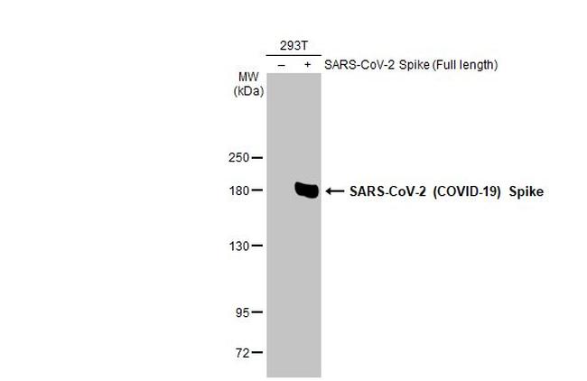 SARS-CoV-2 Spike Protein S1 Antibody in Western Blot (WB)