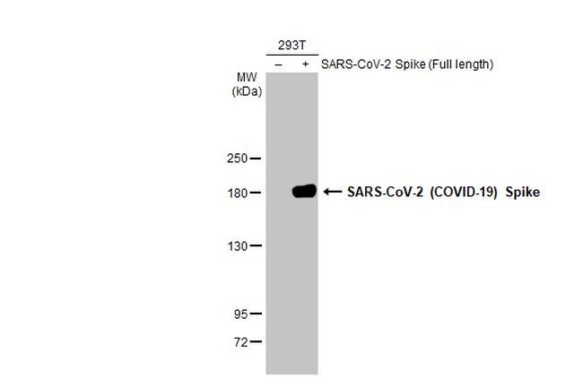 SARS-CoV-2 Spike Protein S1 Antibody in Western Blot (WB)