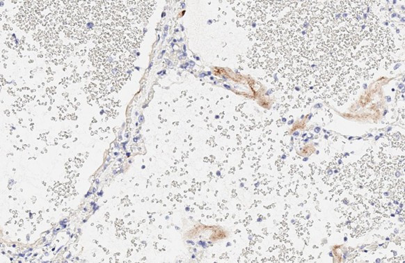 SARS-CoV-2 Spike Protein S1 Antibody in Immunohistochemistry (Paraffin) (IHC (P))