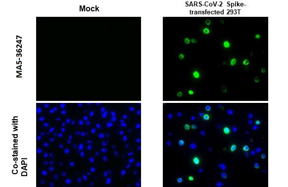 SARS-CoV-2 Spike Protein S1 Antibody in Immunocytochemistry (ICC/IF)