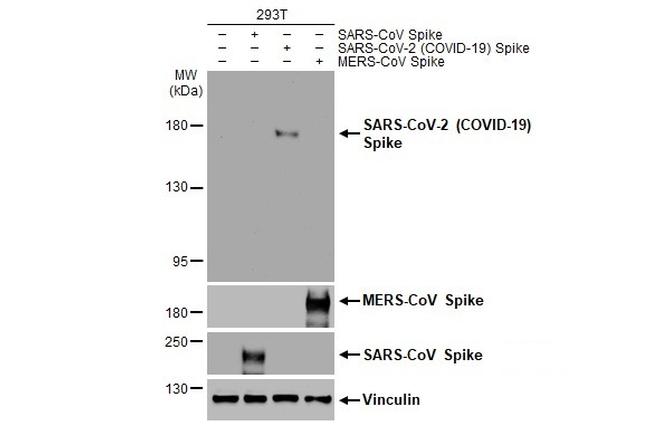 SARS-CoV-2 Spike Protein S1 Antibody in Western Blot (WB)