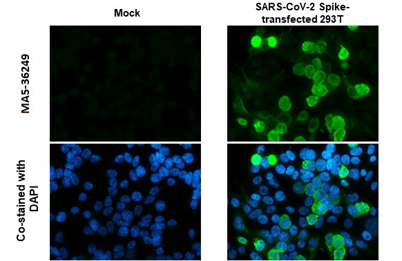 SARS-CoV-2 Spike Protein S1 Antibody in Immunocytochemistry (ICC/IF)