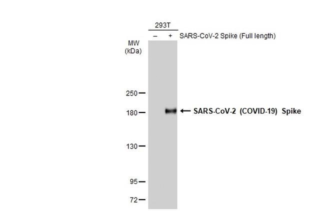 SARS-CoV-2 Spike Protein S1 Antibody in Western Blot (WB)