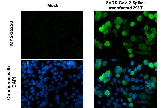 SARS-CoV-2 Spike Protein S1 Antibody in Immunocytochemistry (ICC/IF)