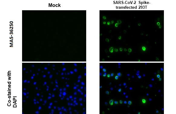 SARS-CoV-2 Spike Protein S1 Antibody in Immunocytochemistry (ICC/IF)