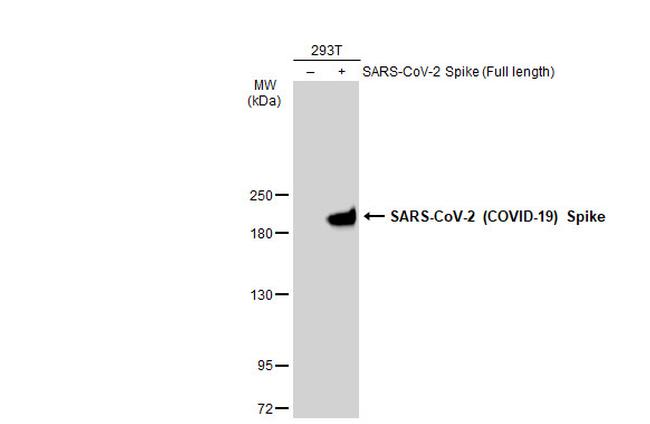 SARS-CoV-2 Spike Protein S1 Antibody in Western Blot (WB)