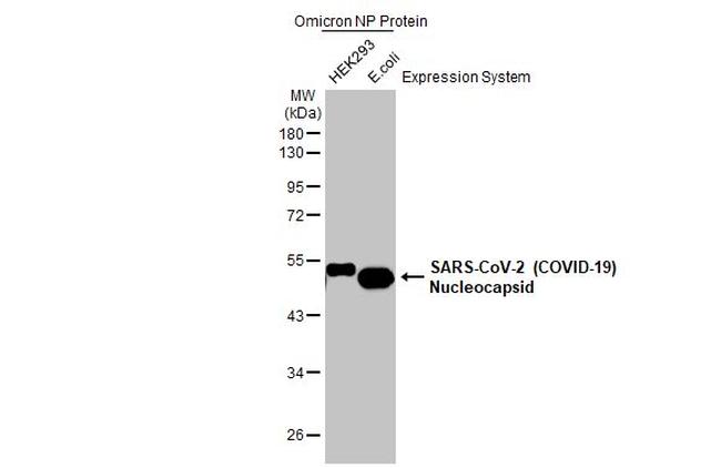 SARS-CoV-2 Nucleocapsid Antibody in Western Blot (WB)