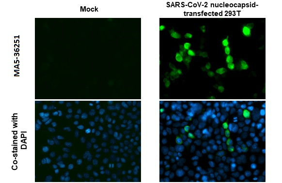 SARS-CoV-2 Nucleocapsid Antibody in Immunocytochemistry (ICC/IF)