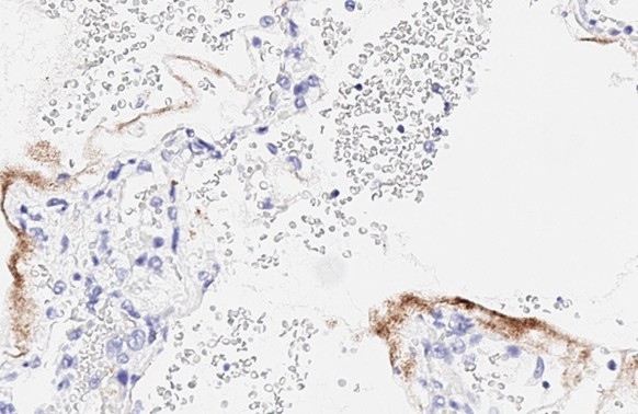 SARS-CoV-2 Nucleocapsid Antibody in Immunohistochemistry (Paraffin) (IHC (P))