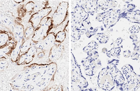 SARS-CoV-2 Nucleocapsid Antibody in Immunohistochemistry (Paraffin) (IHC (P))