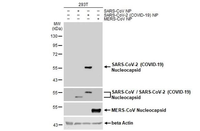 SARS-CoV-2 Nucleocapsid Antibody in Western Blot (WB)