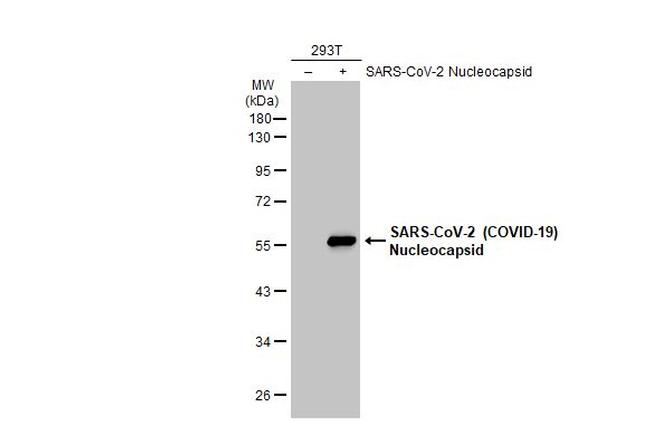 SARS-CoV-2 Nucleocapsid Antibody in Western Blot (WB)