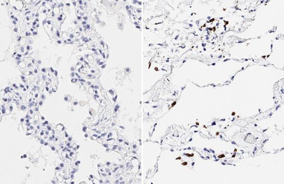 SARS-CoV-2 Spike Protein (RBD) Antibody in Immunohistochemistry (Paraffin) (IHC (P))