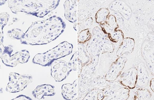 SARS-CoV-2 Spike Protein (RBD) Antibody in Immunohistochemistry (Paraffin) (IHC (P))