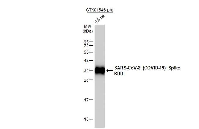 SARS-CoV-2 Spike Protein (RBD) Antibody in Western Blot (WB)