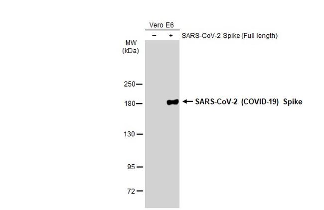 SARS-CoV-2 Spike Protein (RBD) Antibody in Western Blot (WB)