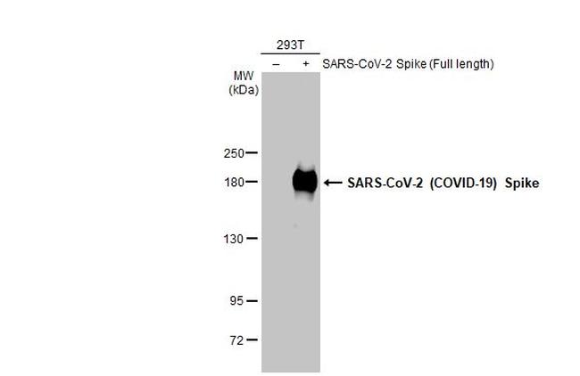 SARS-CoV-2 Spike Protein (RBD) Antibody in Western Blot (WB)