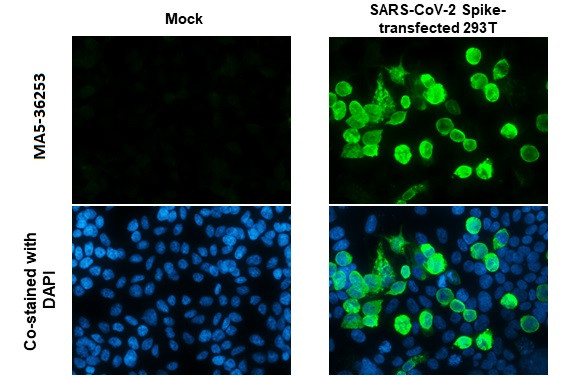 SARS-CoV-2 Spike Protein (RBD) Antibody in Immunocytochemistry (ICC/IF)