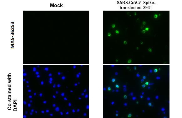 SARS-CoV-2 Spike Protein (RBD) Antibody in Immunocytochemistry (ICC/IF)