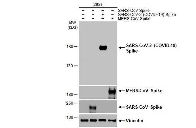 SARS-CoV-2 Spike Protein (RBD) Antibody in Western Blot (WB)